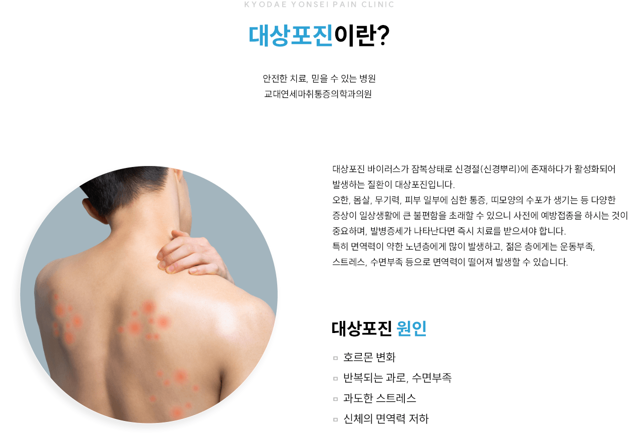 대상포진 관련 증상과 치료를 설명하는 그림